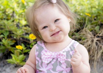 Regular Questions about Down-Syndrome - Down-Syndrome